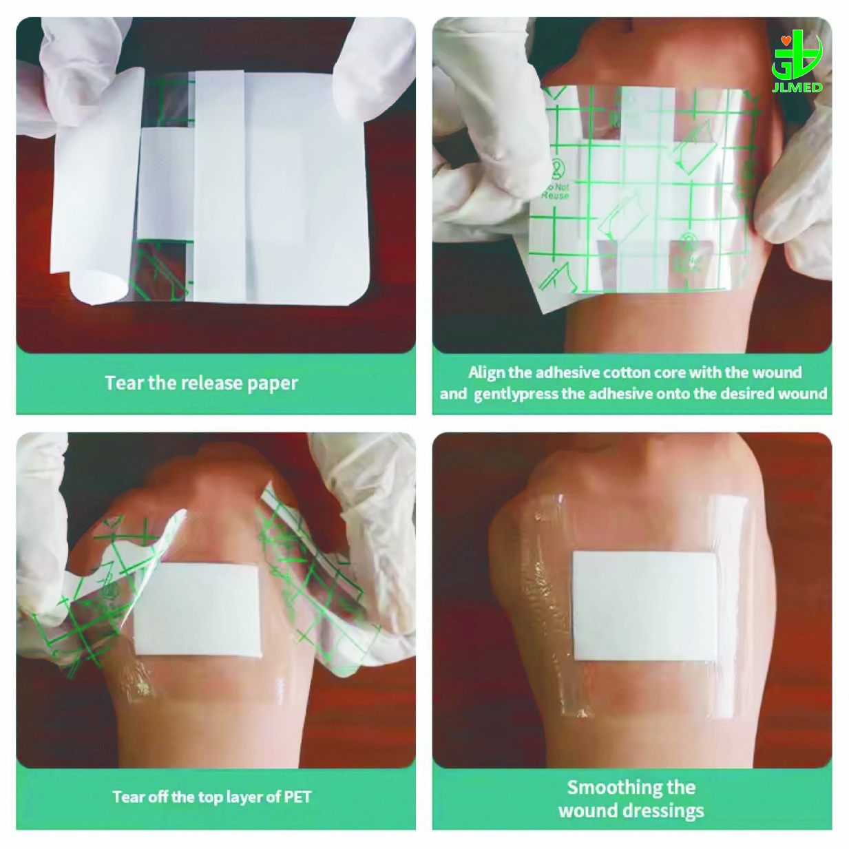 Disposable Wound Dressing Nonwoven Sterile PU Wound Dressing